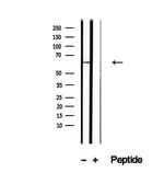 IkB zeta Antibody in Western Blot (WB)