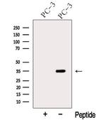 ARPC2 Antibody in Western Blot (WB)