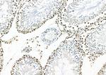 APITD1 Antibody in Immunohistochemistry (Paraffin) (IHC (P))