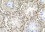 APITD1 Antibody in Immunohistochemistry (Paraffin) (IHC (P))