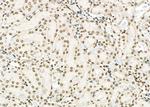 APITD1 Antibody in Immunohistochemistry (Paraffin) (IHC (P))