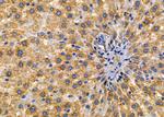 IL12RB1 Antibody in Immunohistochemistry (Paraffin) (IHC (P))