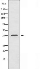 TUSC3 Antibody in Western Blot (WB)