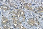 SMO Antibody in Immunohistochemistry (Paraffin) (IHC (P))