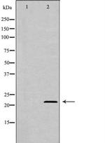 Adenylate Kinase 1 Antibody in Western Blot (WB)