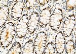 XPB Antibody in Immunohistochemistry (Paraffin) (IHC (P))