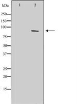 XPB Antibody in Western Blot (WB)