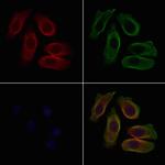 Urotensin II Receptor Antibody in Immunocytochemistry (ICC/IF)