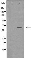 Urotensin II Receptor Antibody in Western Blot (WB)