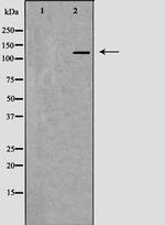 MSH3 Antibody in Western Blot (WB)