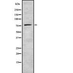 GUCY1A3 Antibody in Western Blot (WB)