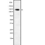 AATK Antibody in Western Blot (WB)