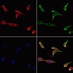 RNF6 Antibody in Immunocytochemistry (ICC/IF)