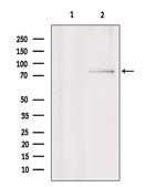 RNF6 Antibody in Western Blot (WB)