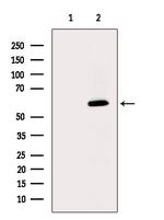 ETNPPL Isoform 1 Antibody in Western Blot (WB)