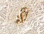 LRP12 Isoform A Precursor Antibody in Immunohistochemistry (Paraffin) (IHC (P))