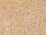 LRP12 Isoform A Precursor Antibody in Immunohistochemistry (Paraffin) (IHC (P))