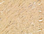 UBE2A/UBE2B Antibody in Immunohistochemistry (Paraffin) (IHC (P))