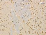 UBE2A/UBE2B Antibody in Immunohistochemistry (Paraffin) (IHC (P))