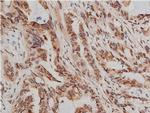 Phospho-AKT1/AKT2/AKT3 (Ser473) Antibody in Immunohistochemistry (Paraffin) (IHC (P))