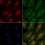 RON Antibody in Immunocytochemistry (ICC/IF)