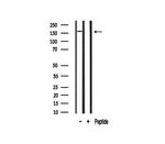 RON Antibody in Western Blot (WB)