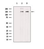 RON Antibody in Western Blot (WB)