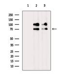 Involucrin Antibody in Western Blot (WB)