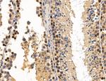 MCM5 Antibody in Immunohistochemistry (Paraffin) (IHC (P))