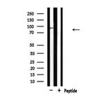 MCM5 Antibody in Western Blot (WB)