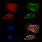 Pan Ras Antibody in Immunocytochemistry (ICC/IF)