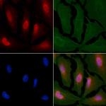 Sodium Channel Pan Antibody in Immunocytochemistry (ICC/IF)