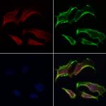 Sodium Channel Pan Antibody in Immunocytochemistry (ICC/IF)