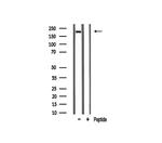 Sodium Channel Pan Antibody in Western Blot (WB)