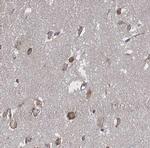 PIAS3 Antibody in Immunohistochemistry (Paraffin) (IHC (P))