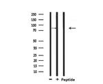 SENP5 Antibody in Western Blot (WB)