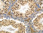 SENP6 Antibody in Immunohistochemistry (Paraffin) (IHC (P))