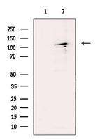 SENP6 Antibody in Western Blot (WB)