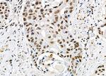 UBA2 Antibody in Immunohistochemistry (Paraffin) (IHC (P))