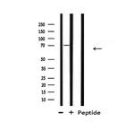 UBA2 Antibody in Western Blot (WB)