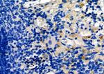 LIGHT Antibody in Immunohistochemistry (Paraffin) (IHC (P))