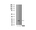 KIP2 Antibody in Western Blot (WB)