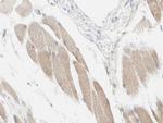 NDUFC2 Antibody in Immunohistochemistry (Paraffin) (IHC (P))