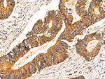 TRIM16 Antibody in Immunohistochemistry (Paraffin) (IHC (P))