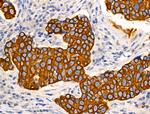 TRIM16 Antibody in Immunohistochemistry (Paraffin) (IHC (P))