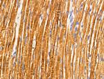 TRIM16 Antibody in Immunohistochemistry (Paraffin) (IHC (P))