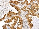 TRIM16 Antibody in Immunohistochemistry (Paraffin) (IHC (P))