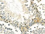 DMC1 Antibody in Immunohistochemistry (Paraffin) (IHC (P))