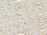 FYCO1 Antibody in Immunohistochemistry (Paraffin) (IHC (P))