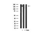 FYCO1 Antibody in Western Blot (WB)